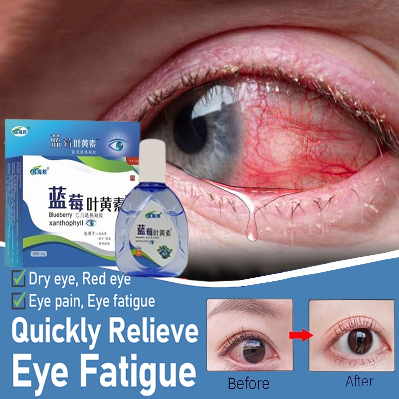 Blueberry Lutein Eye Drop 15g Eye Fatigue Eye Drops For Dry Eye Ubat 