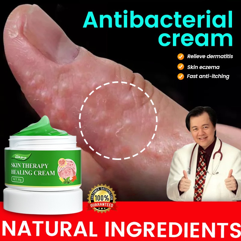 🔥Eczema Cream🔥Antifungal Cream Antifungal Psoriasis Itchy Cream Perfect Skin Antibacterial Baby