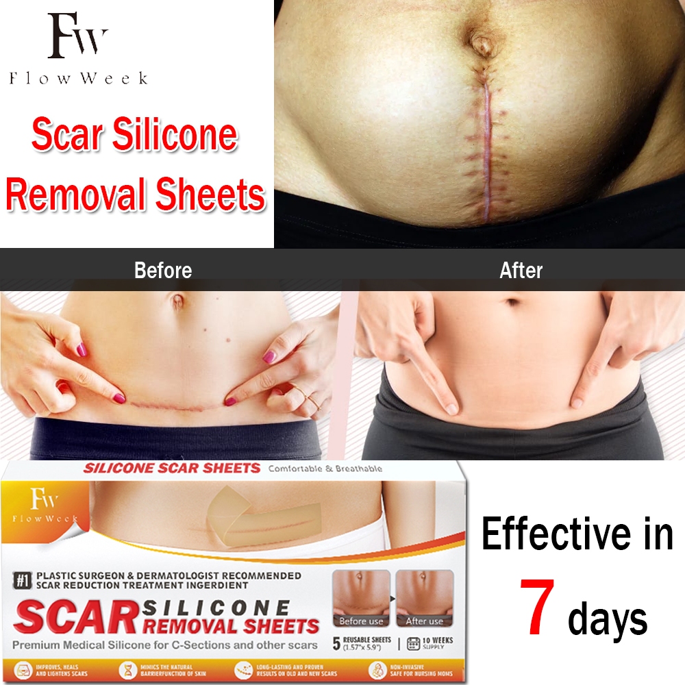 [2-Day Delivery]Flowweek Scar Patch Silicone Plaster Scar Removal ...