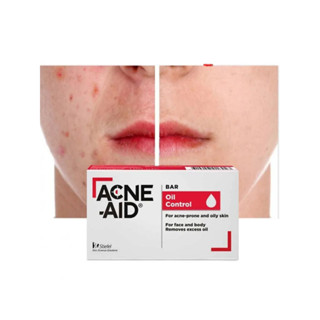 Acne-Aid Bar Soap (100g) (For acne-prone and oily skin) | Shopee Malaysia