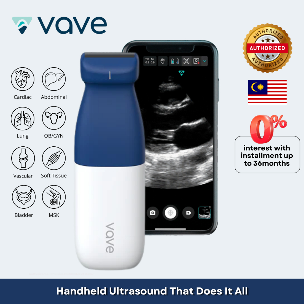 Vave Universal Probe - Wireless Ultrasound | Portable | FDA/MDA ...