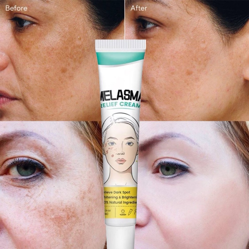 Crème Visage Éclaircissante Thaïlandaise Anti-Taches (Mélasma) - SPF7 - Aloe Vera - 10ml