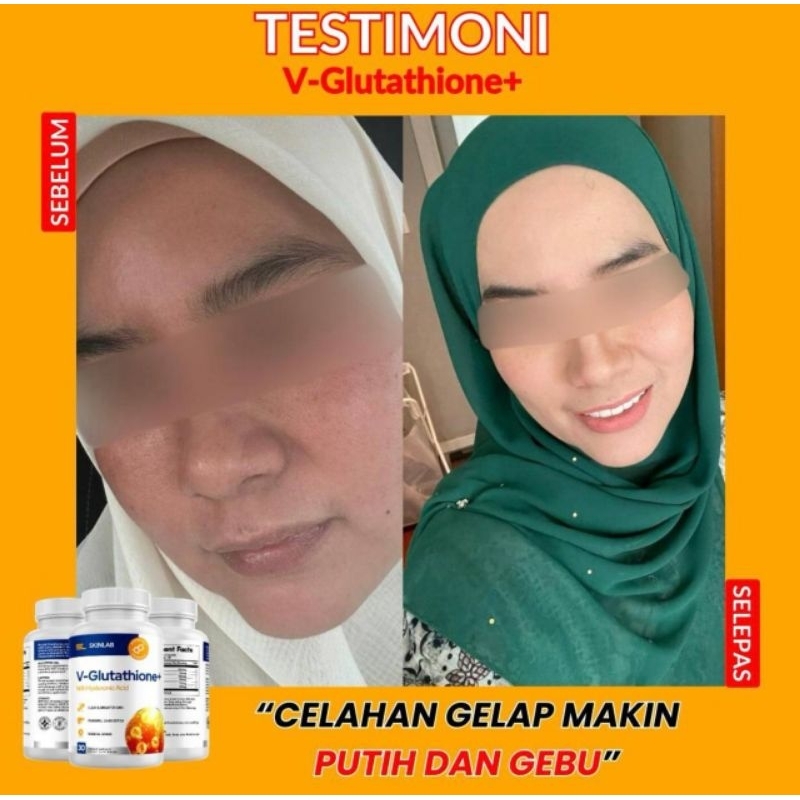 READY STOCK V-GLUTATHIONE MY SKIN LAB 30 CAPSULE | Shopee Malaysia