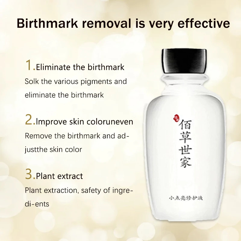 100ml 消胎记 Birthmark Remover Solution Birthmark Removal liquid Remove ...
