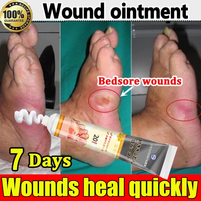 Bedsore cream diabetic treatment cream bedsore patch treatment cream ...