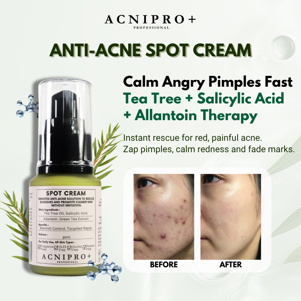 ACNIPRO+ Anti-Acne Spot Cream 30ml | Blemish Control, Targeted Repair ...
