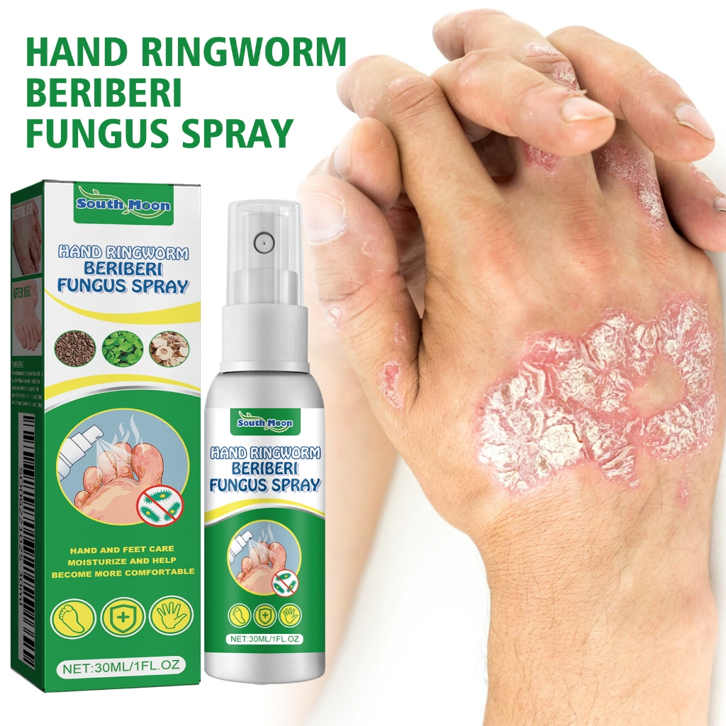 South Moon Hand Ringworm Beriberi Fungus Spray 30ml Antibacterial Foot ...