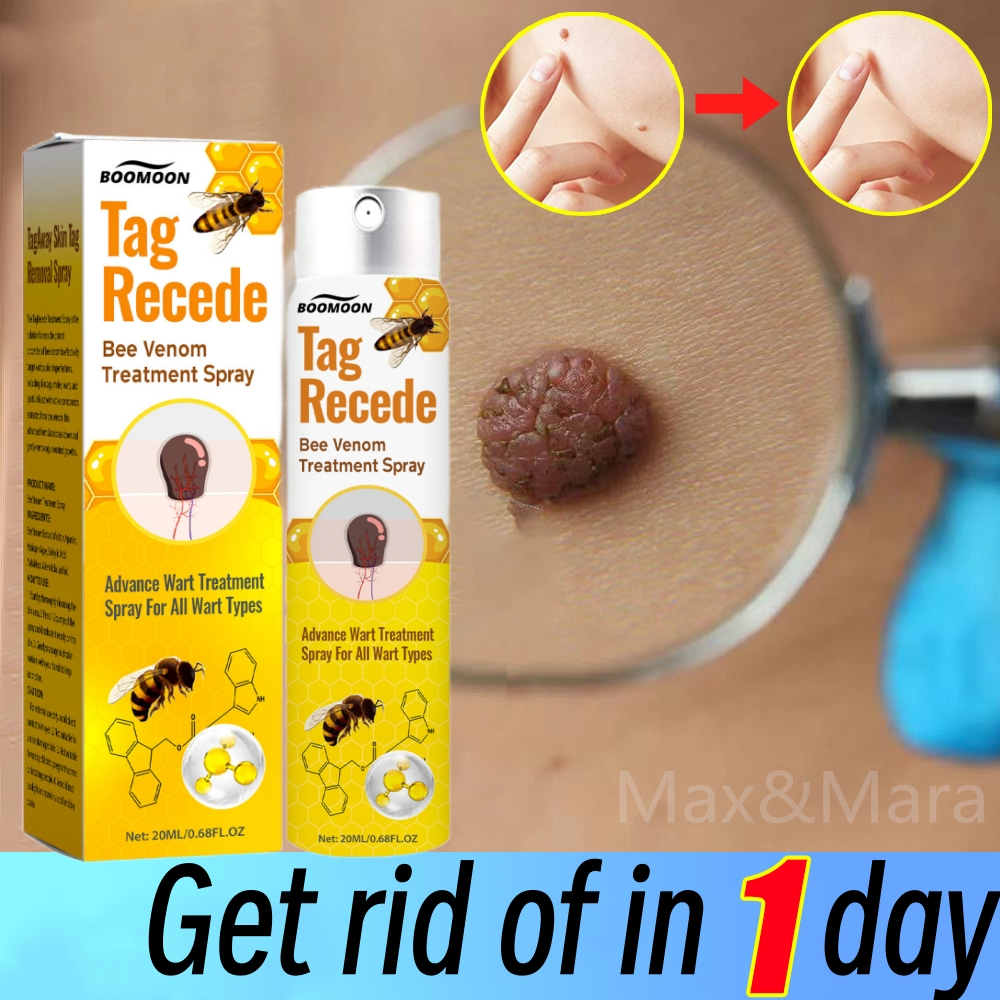 Tag Recede Bee Venom Spray Ubat Ketuat Kutil Skin Tag Remover Ubat ...