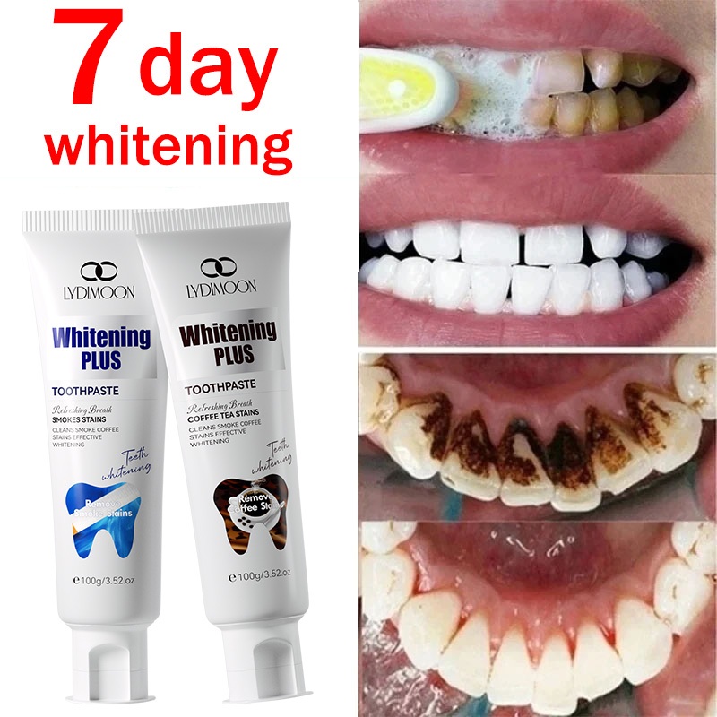 toothpaste whitening teeth Probiotic Toothpaste Tooth Stain Removal ...