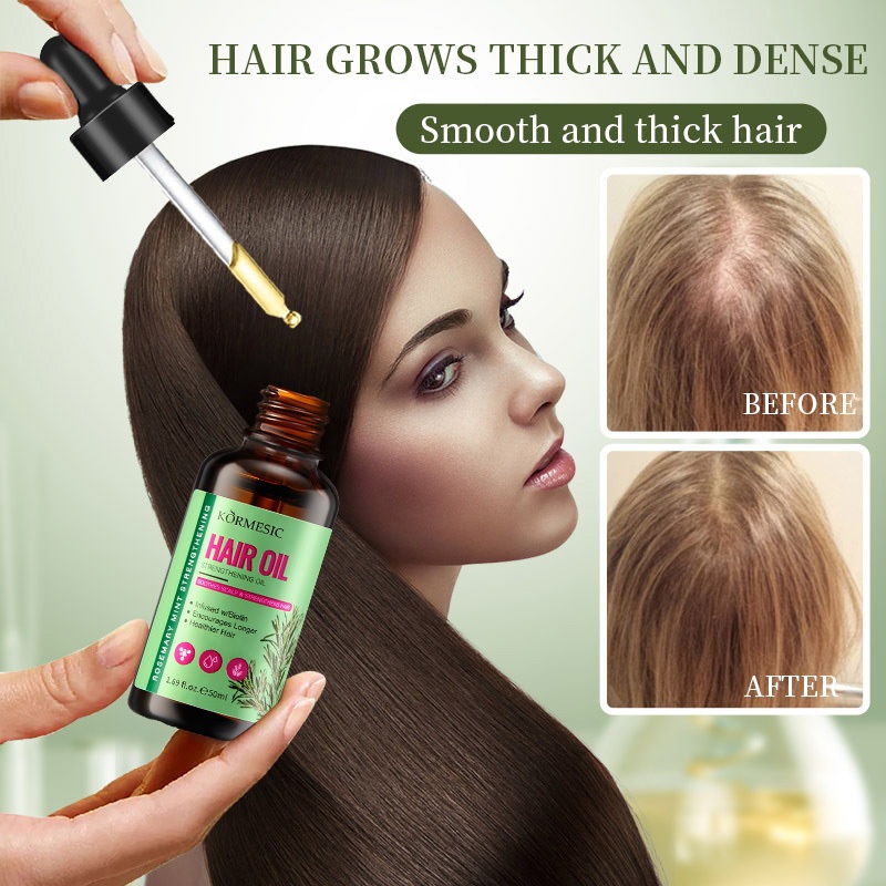 rosemary-mint-scalp-hair-strengthening-oil-hair-grower-treatment-anti