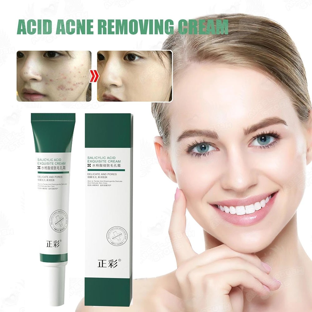 Amazon.com: Blackhead Removal Cream