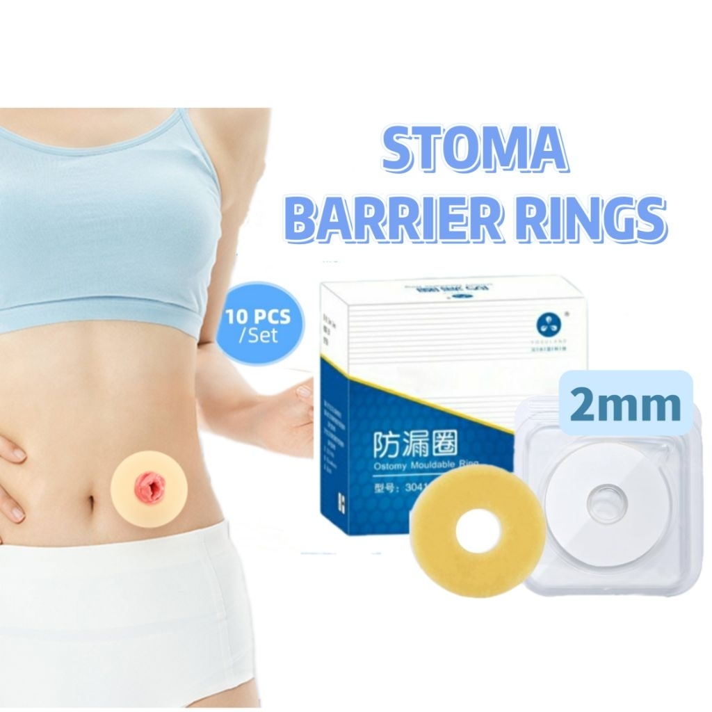 [10PCS] 2mm Ostomy Stoma Skin Barrier Rings Moldable Ostomy Ring ...