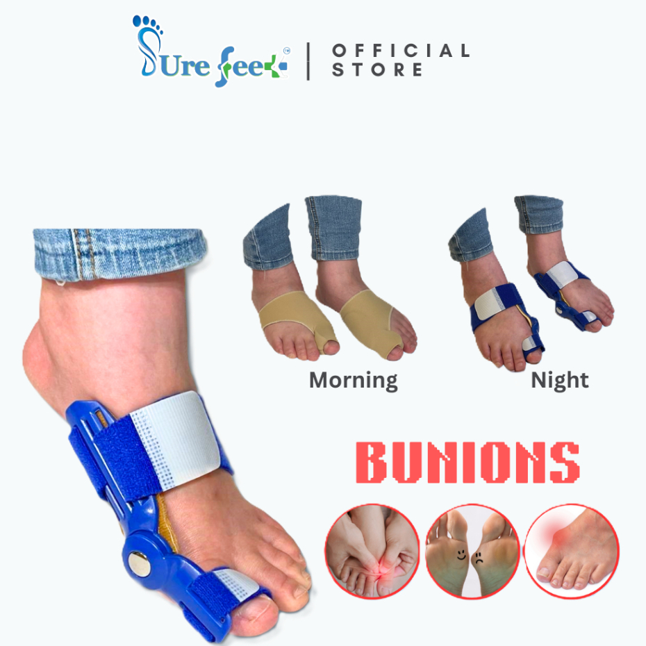 SURE FEET Toe Corrector Orthotics for Hallux Valgus/Adjustable Bunion ...