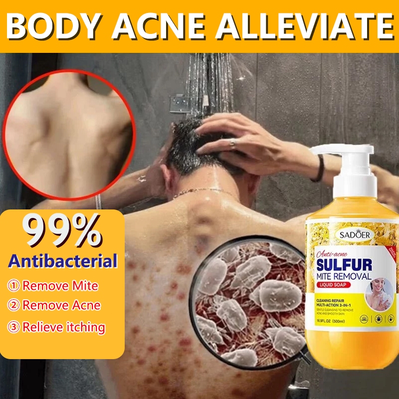 shower gel Anti Mite Acne body wash 500ml Sulfur relieves itching ...