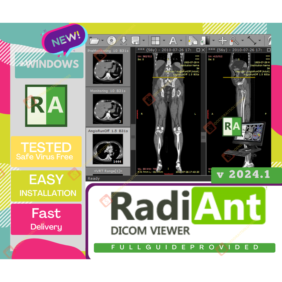 RadiAnt DICOM Viewer 𝐯𝟐𝟎𝟐𝟓 | +VIdeo Guide 🔥 [+For Win+Full.Activted ...
