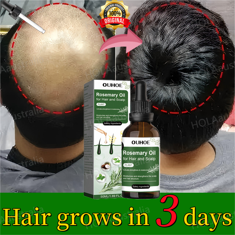 Buy minyak lebatkan rambut Online With Best Price, Jul 2026 | Shopee ...