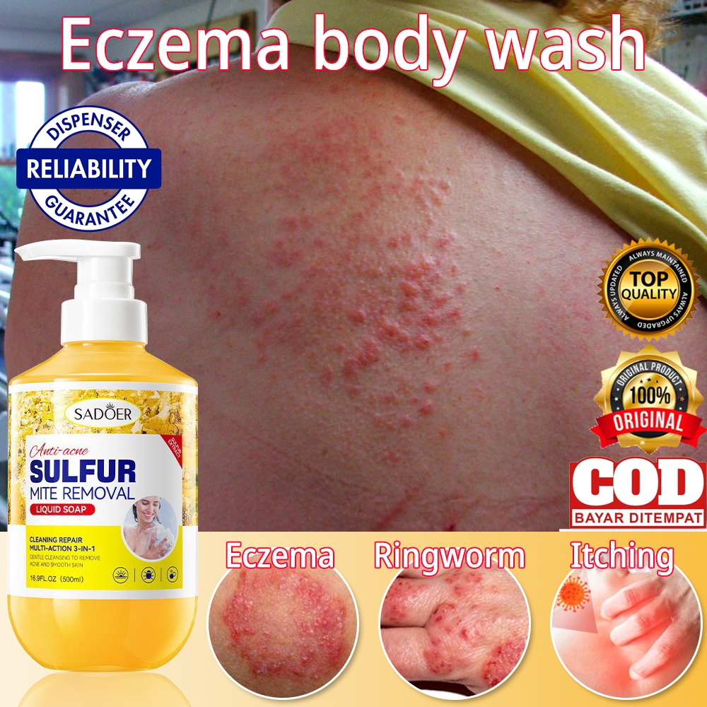 eczema body wash antibacterial body wash sulfur eczema soap liquid ...
