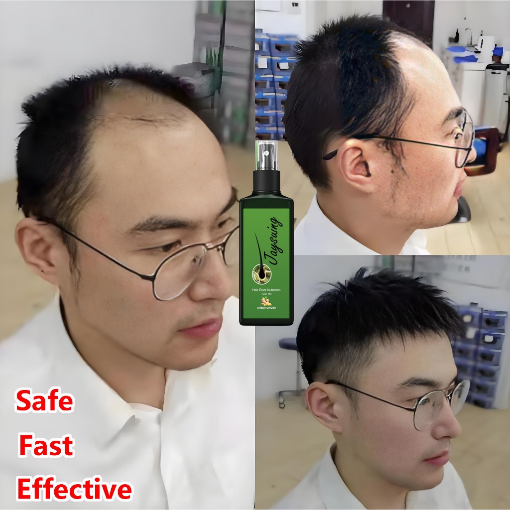 Thumbnail for Hair Growth Serum For Men With Uneven Hair Growth Pattern And Loss