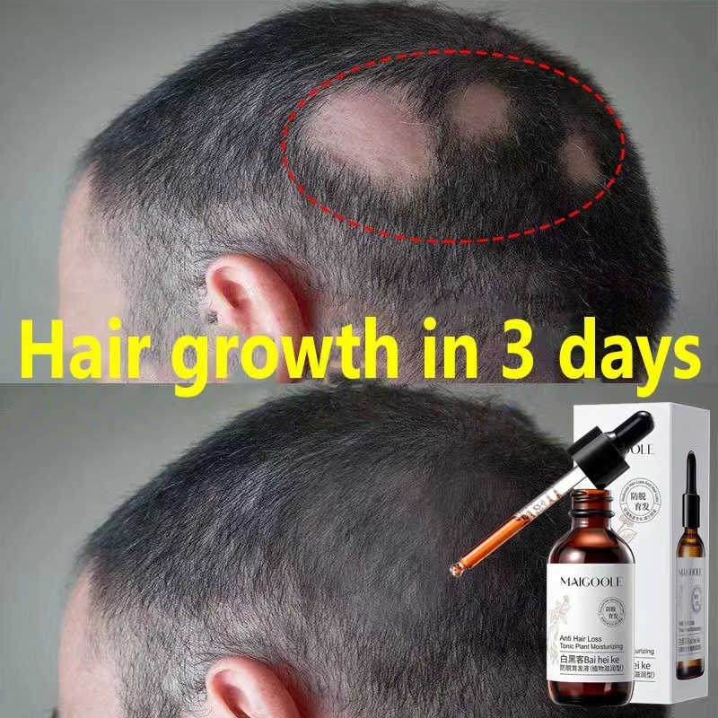 serum rambut gugur Minyak Lebatkan Rambut Rosemary oil air Tonic Hair ...