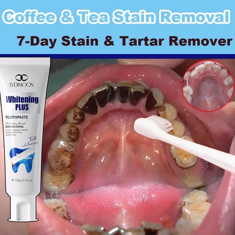 View of LYDIMOON Whitening Toothpaste for Coffee & Tea Stains 100g Remove deep ...