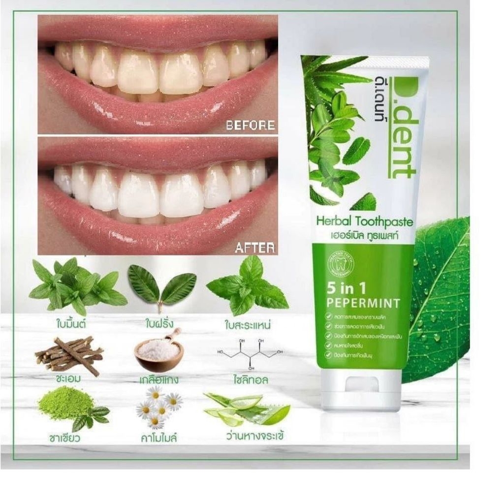 🔥 UBAT GIGI D.DENT HERBAL 5 IN 1 PEPPERMINT TOOTHPASTE D.DENT ...