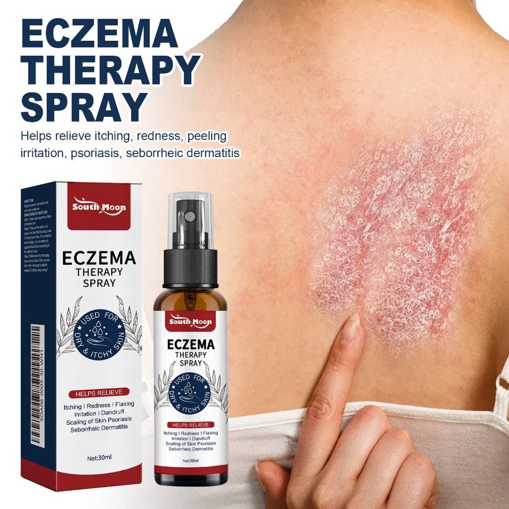 South Moon Psoriasis Relief Spray 30ml Hand Foot Scalp Eczema Tinea ...