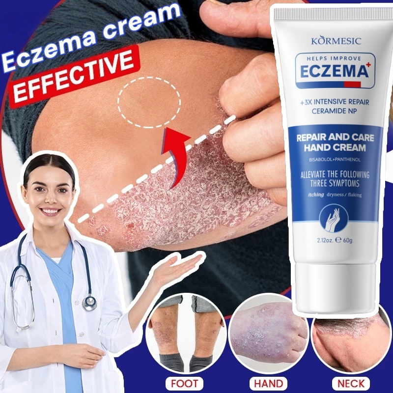 Psoriasis Antifungal Cream For Skin Itchy Eczema Cream Gatal Kulit 60g ...