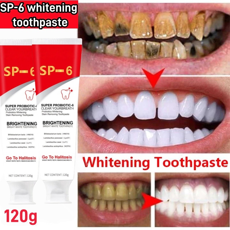 SP-6 Teeth Whitening Toothpaste Probiotic Caries Toothpaste for Bad ...