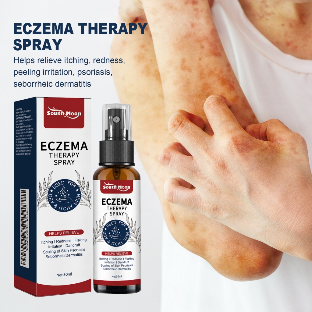 South Moon Eczema Therapy Spray 30ml Anti-Itching Rash Psoriasis Relief ...