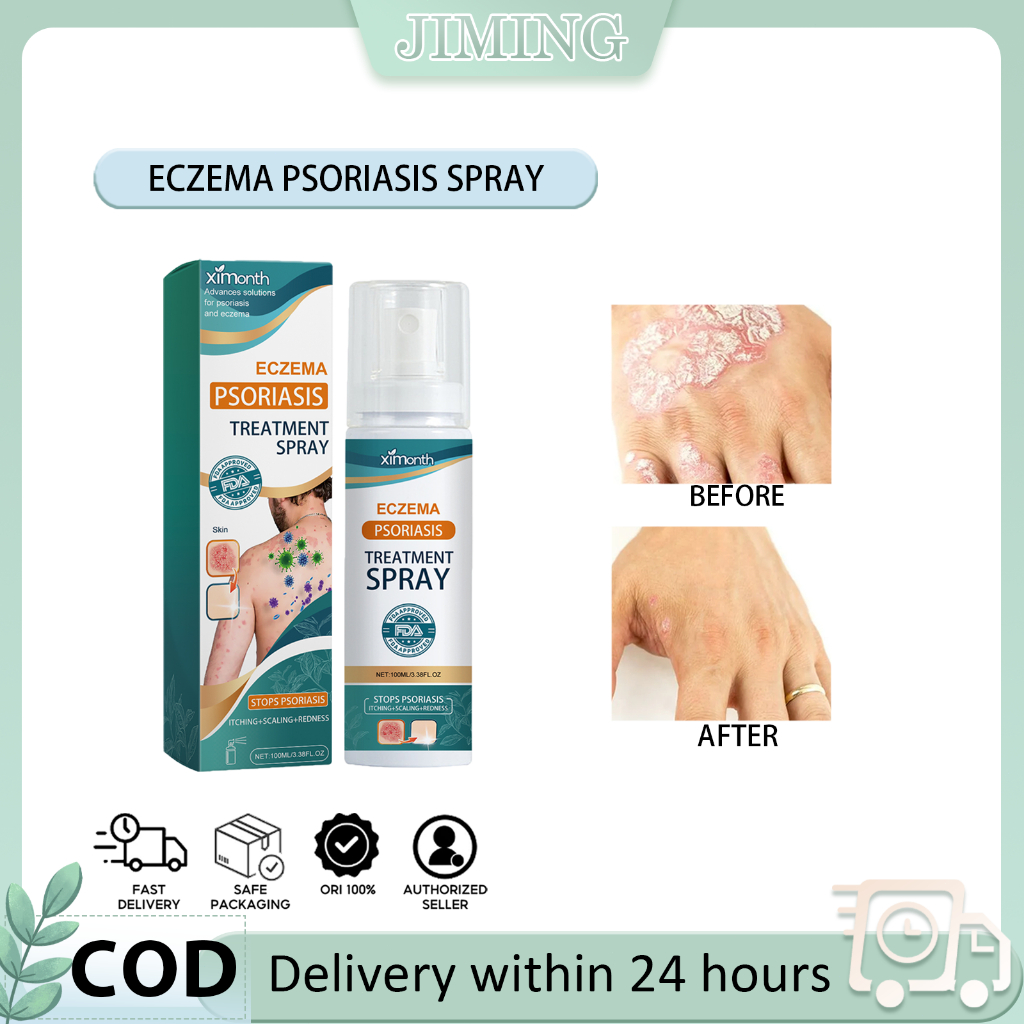 Eczema Psoriasis Spray 100ml Treatment eczema tinea psoriasis relief ...