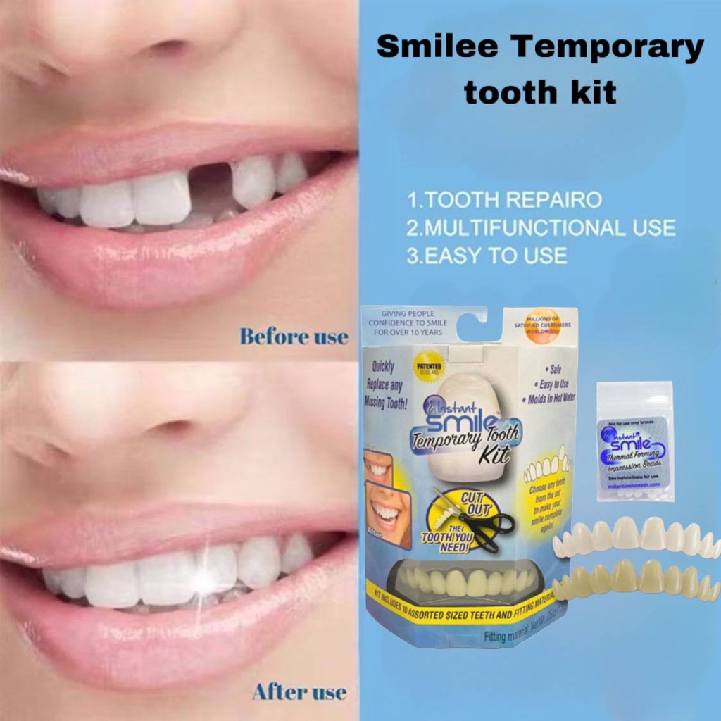 Smile temporary tooth kit Gigi palsu murah khas untuk gigi hilang ...