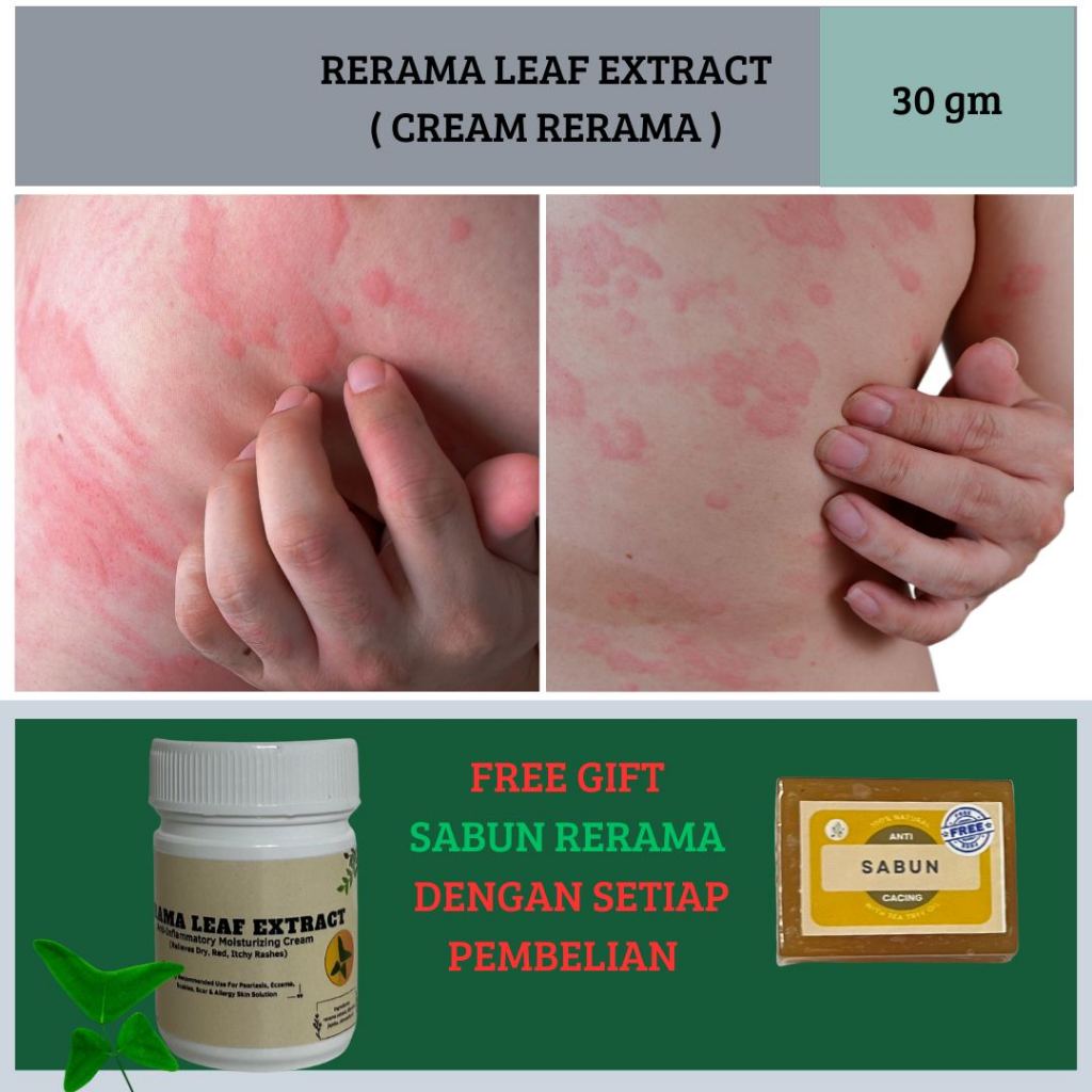 CREAM RERAMA ( 30g ) | Shopee Malaysia