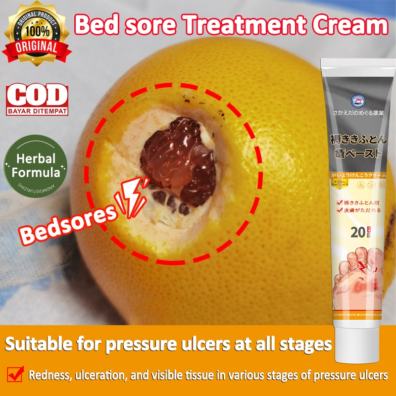 Bedsore Treatment Cream/Pressure Sore Ulcer/Relief Ointment Wound 20g ...
