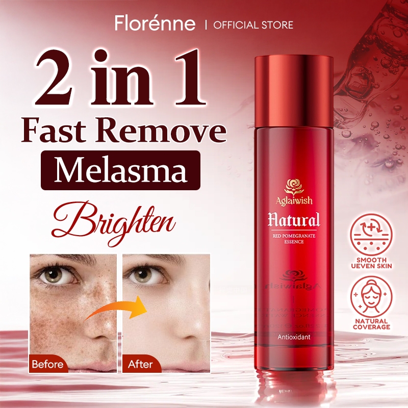 melasma-cream-remove-whitening-freckle-cream-remove-dark-spots-melanin