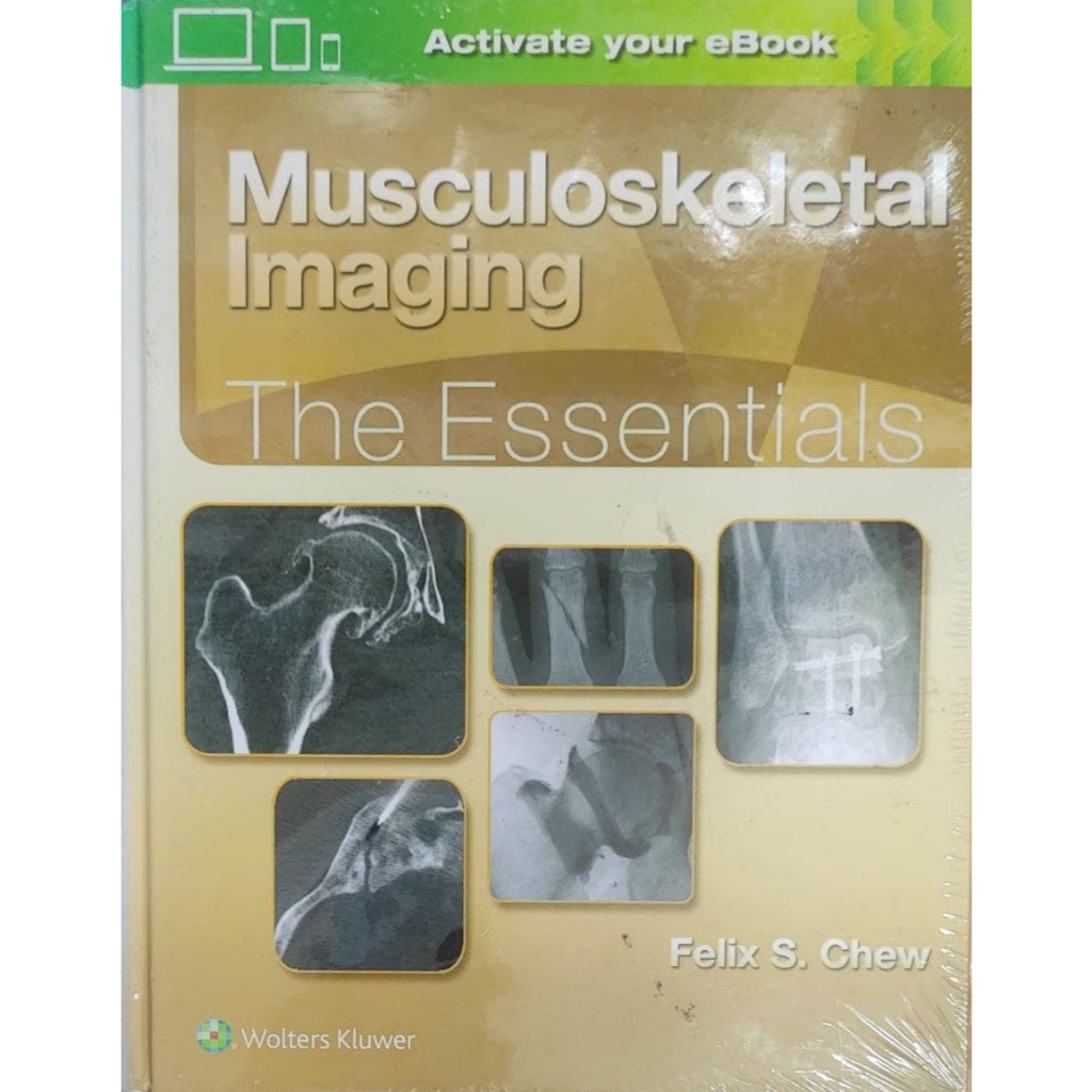 Musculosketetal Imaging The Essentials | Shopee Malaysia