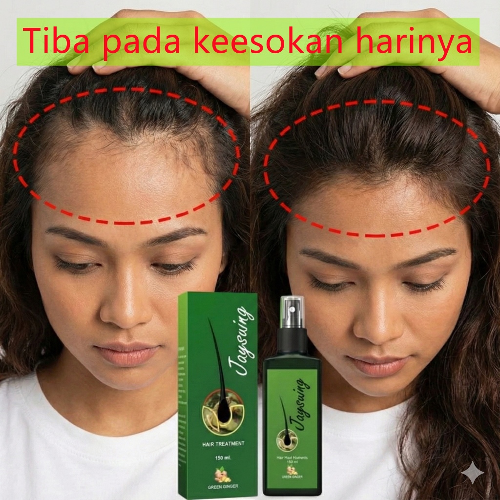 [Ready Stock] Jaysuing Ginger Hair Growth Spray 120ml Anti Hair Loss ...