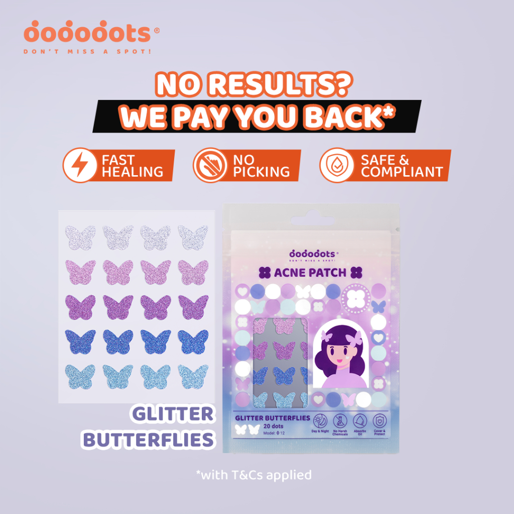 Dododots Pimple Patch - Glitter Butterflies | Fast Healing Waterproof ...