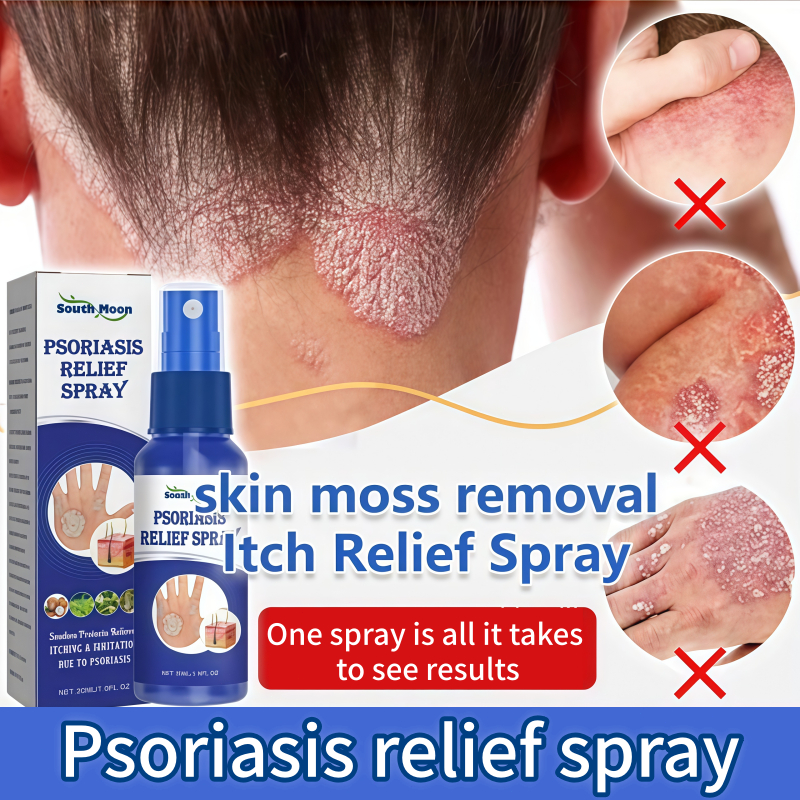 Ubat gatal kulit Ubat kurap Obat gatal Psoriasis Relief Spray Kulit ...