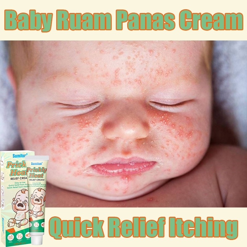heat rash eczema baby cream 30g obat gatal untuk kulit diaper rash ...