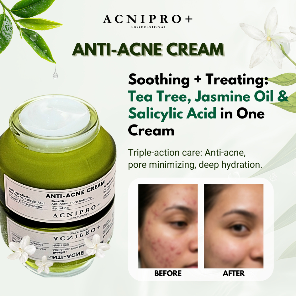 ACNIPRO+ ANTI-ACNE CREAM 50ml | ANTI-ACNE, PORE REFINING, HYDRATING ...