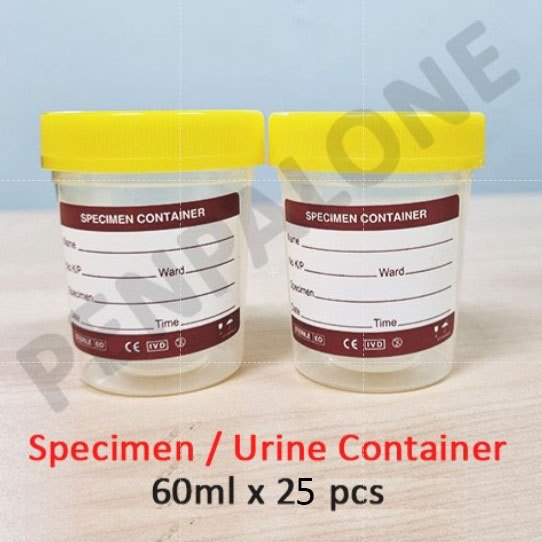 Specimen / Urine Container 60ml - Yellow Cap with Label (25 pcs ...
