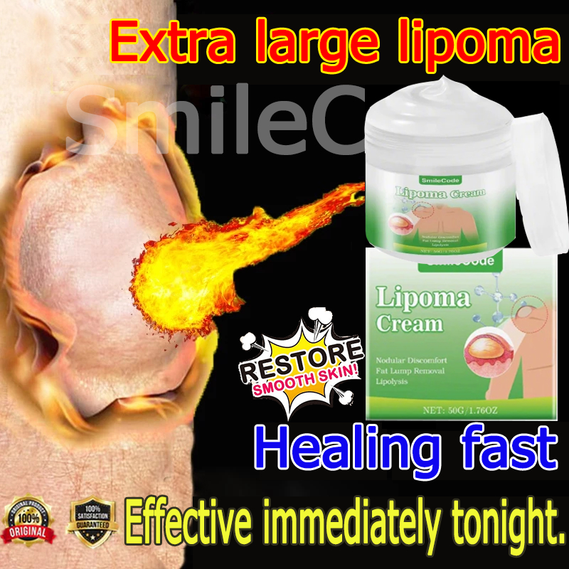 Premium Lipoma Cream Original Lipoma Removal Cream 脂肪瘤膏 50g Natural ...