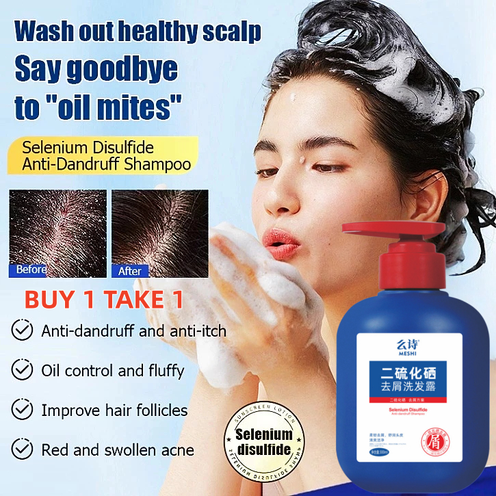 Syampu Penjagaan Rambut Selenium Disulfide Selenium Sulfide Shampoo ...