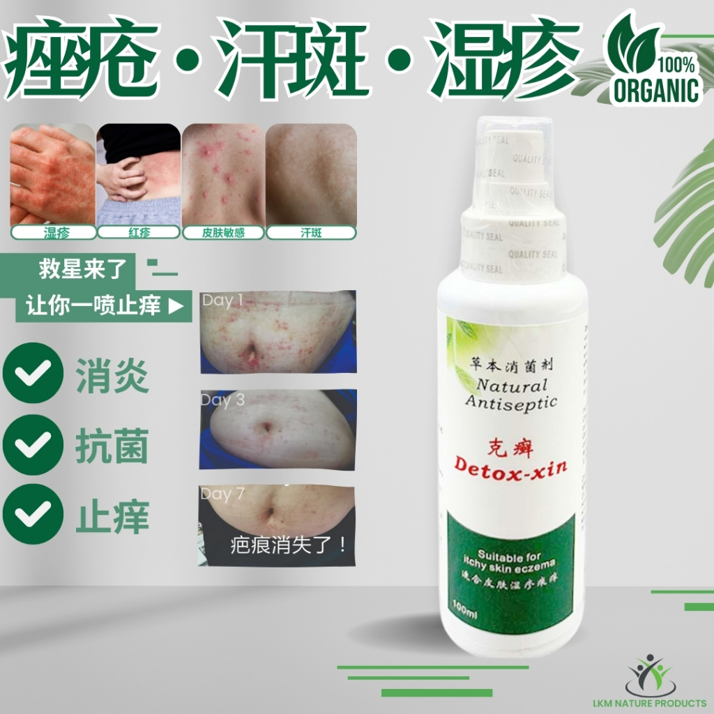 草本克癣喷雾 克癣水 痤疮 汗斑 牛皮廯 湿疹 生蛇 止痒喷雾 止痒水 脱皮 杀菌消炎 Itchy Skin Eczema Spray ...