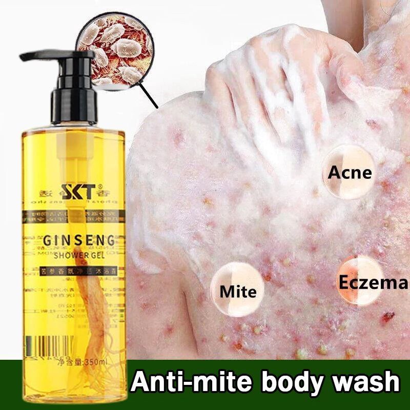 SKT Ginseng Anti-mite Body Wash 350ml Antifungal Remove Acne Mites ...