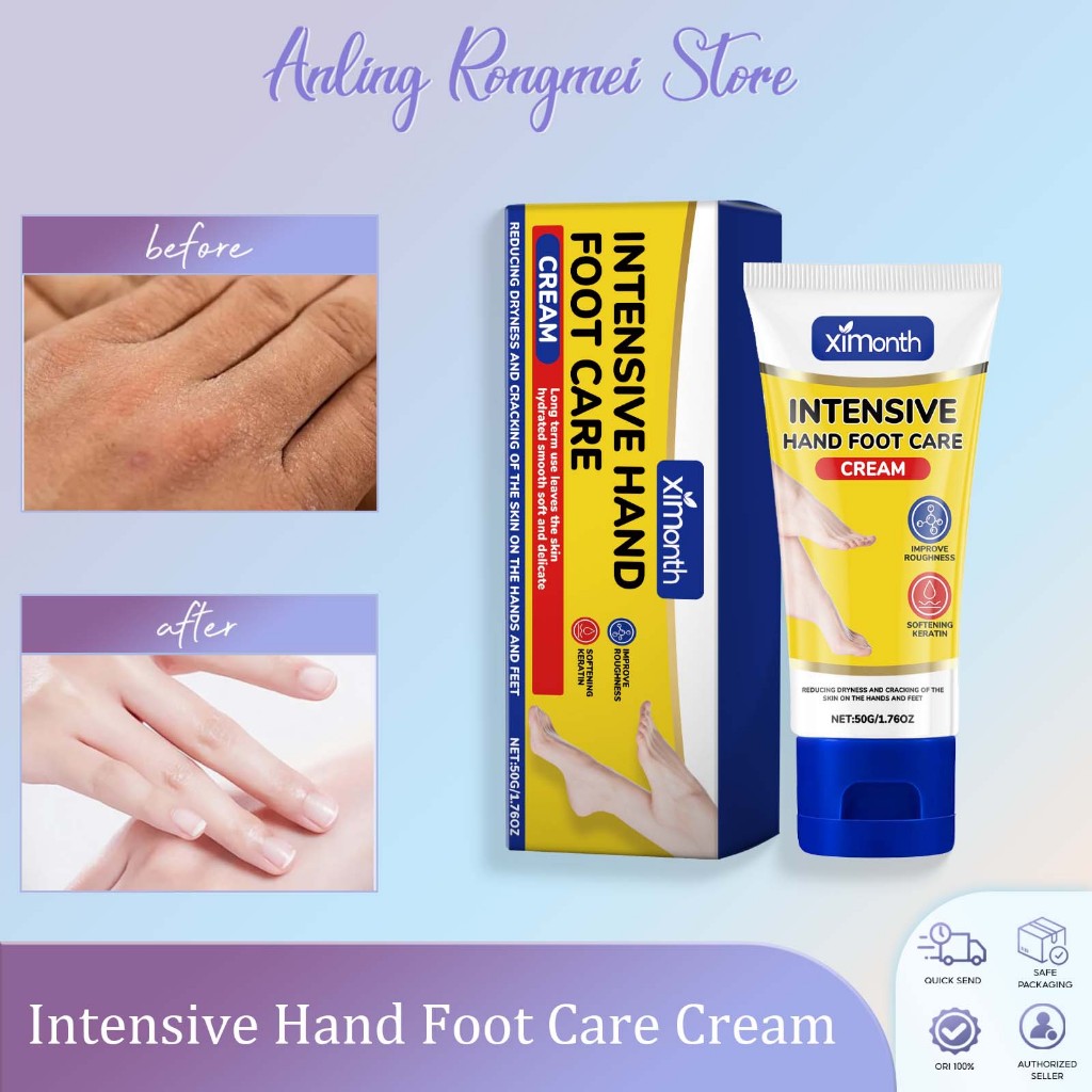 【🔥Ready Stock】Intensive Foot Care Cream 50g Intensive Hand Foot Care ...