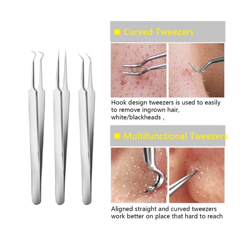 Stainless Steel Pimple Kit Set Besi Picit Jerawat Acne 黑头粉刺针 粉刺夹 ...