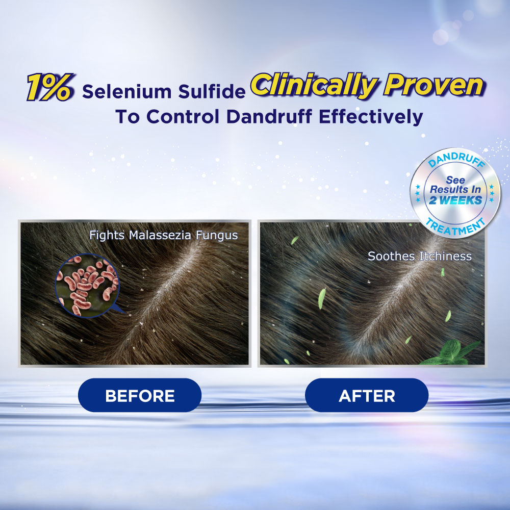 Selsun Blue Pro 2-In-1 Anti-Dandruff Shampoo 120ml | Shopee Malaysia