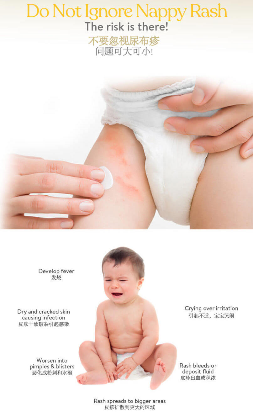 Babe Laboratorios Nappy Rash Cream 100ml Baby Diapering Care