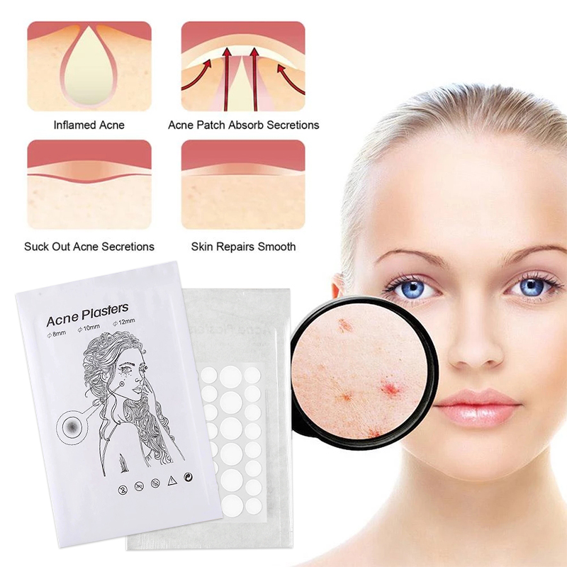 36Pcs Acne Pimple Removal Patch Acne Treatment Stickers Pimple Remover ...